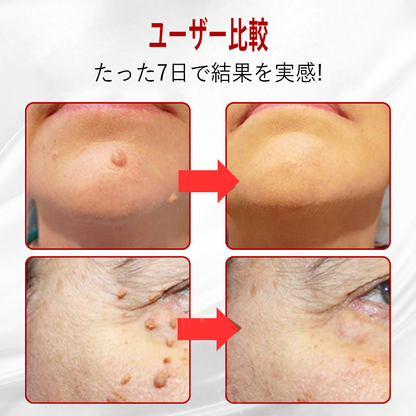 𝐇𝐈𝐒𝐊𝐈𝐍® 残りわずか5箱！今ならさらに50%オフ！健康な体を維持しましょう。このチャンスを逃すと、来年まで待たなければなりません。