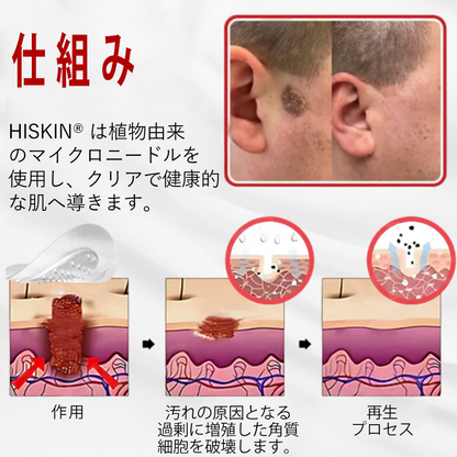 𝐇𝐈𝐒𝐊𝐈𝐍® 残りわずか5箱！今ならさらに50%オフ！健康な体を維持しましょう。このチャンスを逃すと、来年まで待たなければなりません。