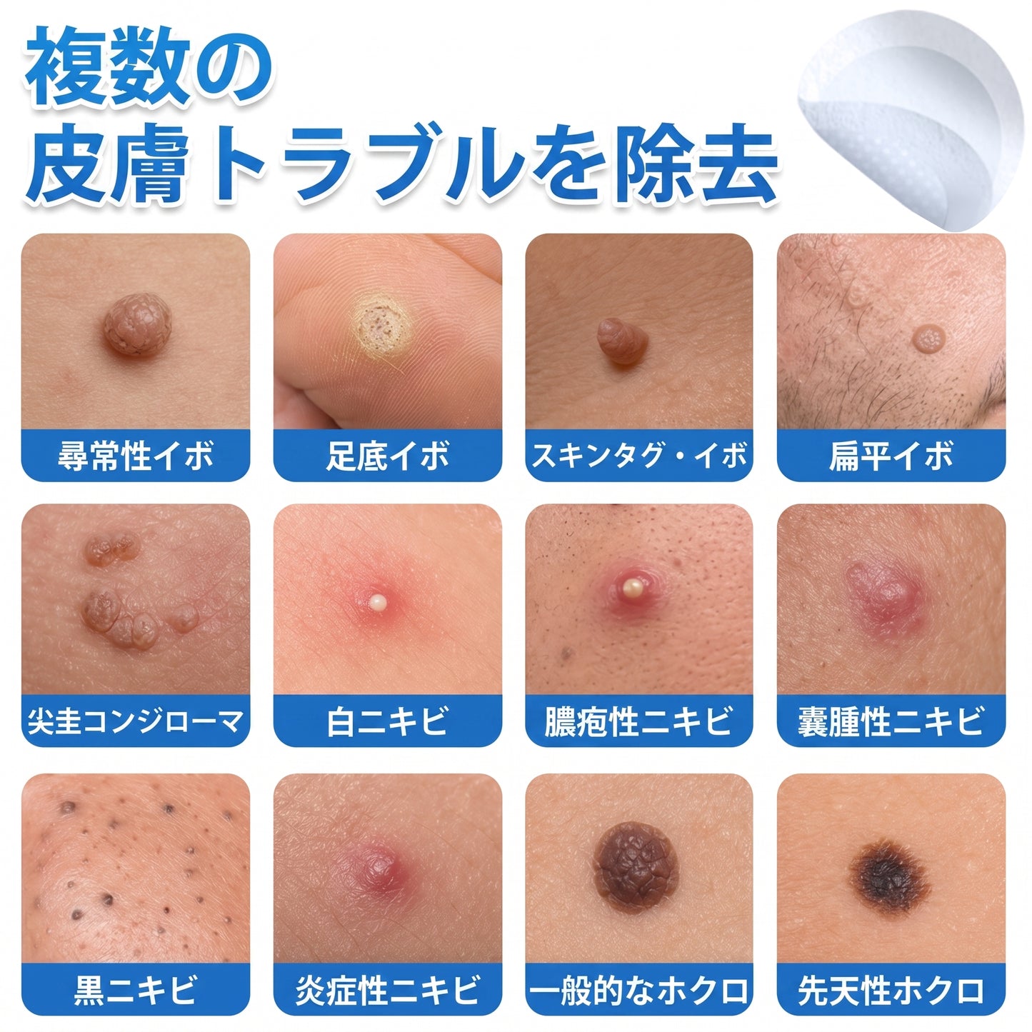 HISKIN® 2-in-1 マイクロニードル＆ハイドロコロイドパッチ｜盛り上がったほくろ・ニキビ・扁平いぼ・スキンタグをケア｜シワ・傷跡・シミを改善｜顔・体用 目立たないニキビパッチ