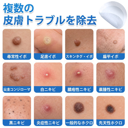 HISKIN® 2-in-1 マイクロニードル＆ハイドロコロイドパッチ｜盛り上がったほくろ・ニキビ・扁平いぼ・スキンタグをケア｜シワ・傷跡・シミを改善｜顔・体用 目立たないニキビパッチ